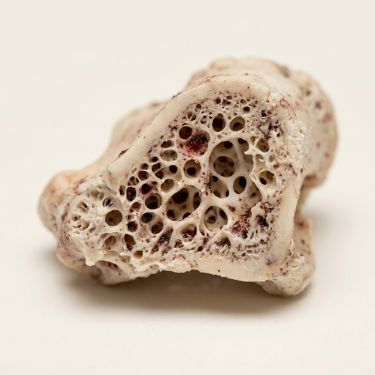 Bone Remineralisation