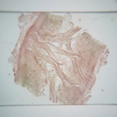 Cartilage & Collagen Matrix